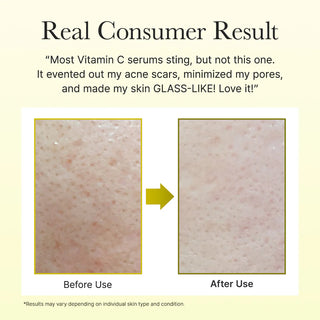 ARENCIA,Vitamin C Booster Shot,Face Serums,Skin-Nomad