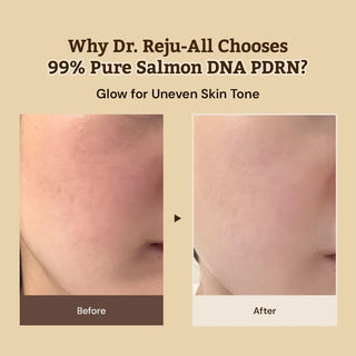 Dr. Reju-All,Advanced PDRN Rejuvenating Cream,Lotions & moisturisers,Skin-Nomad