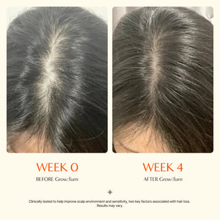 lilyeve,Grow:Turn Exosome Brush Ampoule,Hair Care,Skin-Nomad