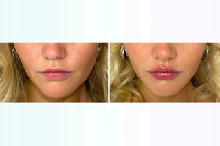 VENICEBEAUTY,Lip Plumping Oil Gloss,4262374310901,Lip Makeup,Skin-Nomad