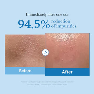 Medicube,Zero Pore Blackhead Deep Cleansing Oil,Facial Cleansers,Skin-Nomad