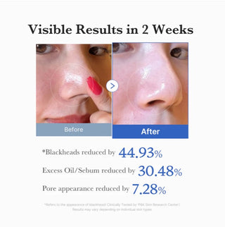 Medicube,Zero Pore Pad 2.0,Skin Care Tools,Skin-Nomad