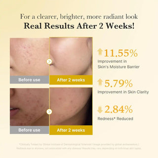 Medicube,Kojic Acid Turmeric Niacinamide Serum,Face Serums,Skin-Nomad