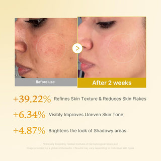 Medicube,Kojic Acid Turmeric Resurfacing Toner,Facial Cleansers,Skin-Nomad