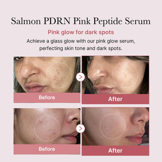 Medicube,PDRN Pink Peptide Serum,serum,8800256108053,Skin-Nomad