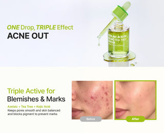PURITO SEOUL,Azelaic Acid 10 Kojic Tea Tree Serum,Face Serums,Skin-Nomad