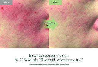 PURITO SEOUL,Wonder Releaf Centella Serum Unscented,8809563100316,Face Serums,Skin-Nomad