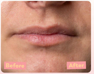 Trew Cosmetic,PeelLip Peeling Aha 5% Marine Bha,lip care,3770014491510,Skin-Nomad