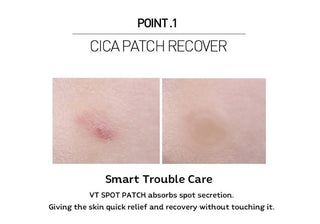 VT COSMETICS,Spot Patch (48ea),Skin Care Tools,Skin-Nomad