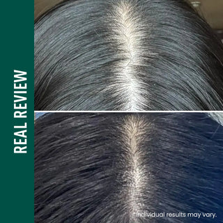 ViveLab,Revive Therapy Hair Scalp & Brow Ampoule,Hair Care,Skin-Nomad