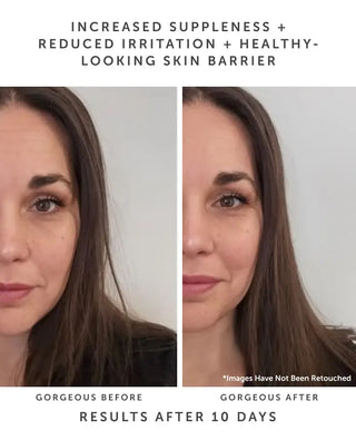 Earth Harbor Naturals HORIZON Ceramide Repair Serum
